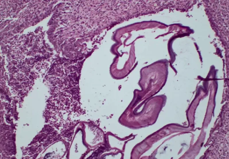 Parasitology Lab sample